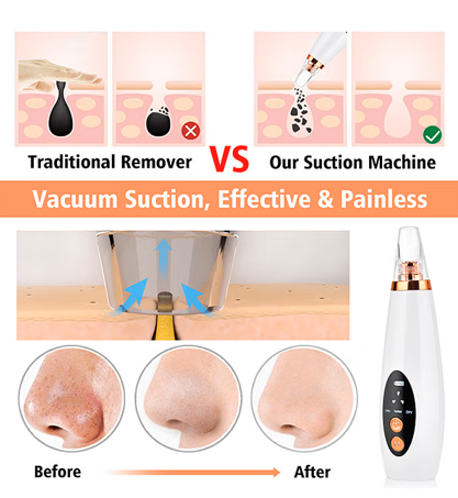LushBlow™ Blackhead Remover Vacuum — Dermatologist-Level Skin Detox at Home